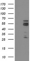 CYP2C9 Antibody in Western Blot (WB)