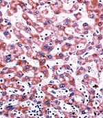 CYP2C9 Antibody in Immunohistochemistry (IHC)