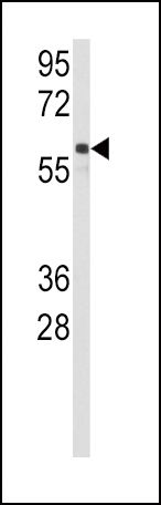 CYP2C9 Antibody in Western Blot (WB)