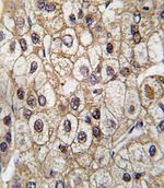 CYP2C9 Antibody in Immunohistochemistry (IHC)