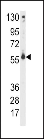 CYP2C9 Antibody in Western Blot (WB)
