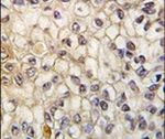 CYP2F1 Antibody in Immunohistochemistry (IHC)