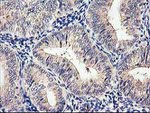 CYP2J2 Antibody in Immunohistochemistry (Paraffin) (IHC (P))