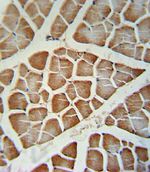 CYP2J2 Antibody in Immunohistochemistry (IHC)