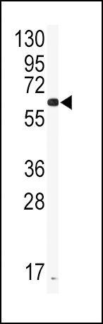 CYP2J2 Antibody in Western Blot (WB)