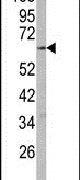 CYP2R1 Antibody in Western Blot (WB)