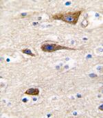 CYP2R1 Antibody in Immunohistochemistry (IHC)