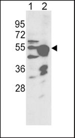 CYP2R1 Antibody in Western Blot (WB)