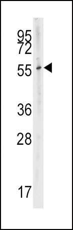 CYP2W1 Antibody in Western Blot (WB)