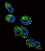 CYP4A11 Antibody in Immunocytochemistry (ICC/IF)