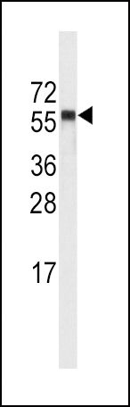 CYP4A11 Antibody in Western Blot (WB)