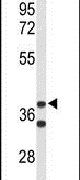 Cytohesin 3 Antibody in Western Blot (WB)