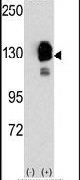 CDH8 Antibody in Western Blot (WB)