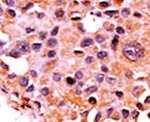 Calcineurin A Antibody in Immunohistochemistry (IHC)