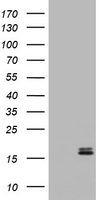 Calcitonin (CALCA) Antibody in Western Blot (WB)