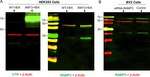 Calcitonin Receptor Antibody in Western Blot (WB)