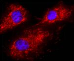Calnexin Monoclonal Antibody (AF18)