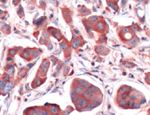 Calpain S1 Antibody in Immunohistochemistry (IHC)