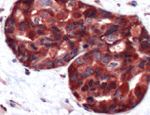 Calpastatin Antibody in Immunohistochemistry (IHC)