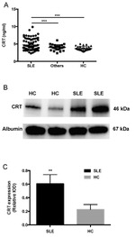 Calreticulin Antibody in Western Blot (WB)