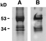 Calreticulin Antibody in Western Blot (WB)
