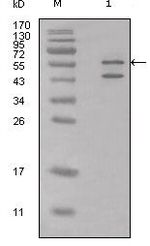 Calreticulin Polyclonal Antibody
