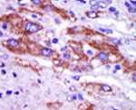 CK1 delta Antibody in Immunohistochemistry (IHC)