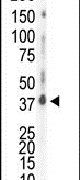 CK1 delta Antibody in Western Blot (WB)