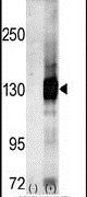 CASK Antibody in Western Blot (WB)