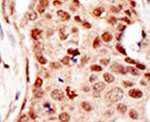 c-Cbl Antibody in Immunohistochemistry (IHC)
