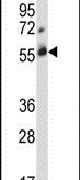c-Cbl Antibody in Western Blot (WB)