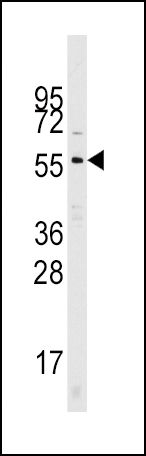 Cdc25A Antibody in Western Blot (WB)