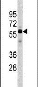 Cdc25A Antibody in Western Blot (WB)