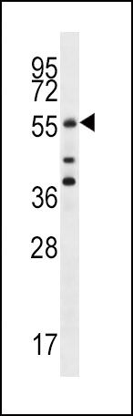 Cdc25A Antibody in Western Blot (WB)