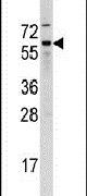 Cdc25B Antibody in Western Blot (WB)