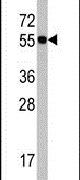 Cdc6 Antibody in Western Blot (WB)