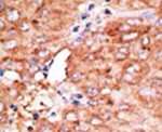 CCRD6 Antibody in Immunohistochemistry (IHC)