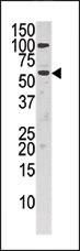 CHKA Antibody in Western Blot (WB)
