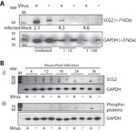 Chromogranin C Antibody in Western Blot (WB)
