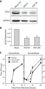 Chromogranin C Antibody in Western Blot (WB)