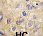 Claudin 1 Antibody in Immunohistochemistry (IHC)