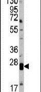 Claudin 1 Antibody in Western Blot (WB)