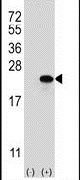 Claudin 1 Antibody in Western Blot (WB)