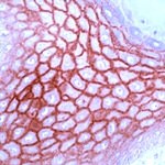 Claudin 1 Antibody in Immunohistochemistry (IHC)