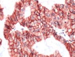 Claudin 4 Antibody in Immunohistochemistry (IHC)