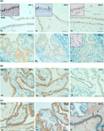 Claudin 2 Antibody in Immunohistochemistry (IHC)