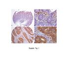 Claudin 2 Antibody in Immunohistochemistry (IHC)