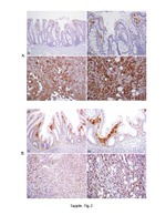Claudin 2 Antibody in Immunohistochemistry (IHC)