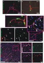 Claudin 5 Antibody in Immunohistochemistry (IHC)