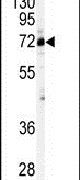 CSTF2 Antibody in Western Blot (WB)